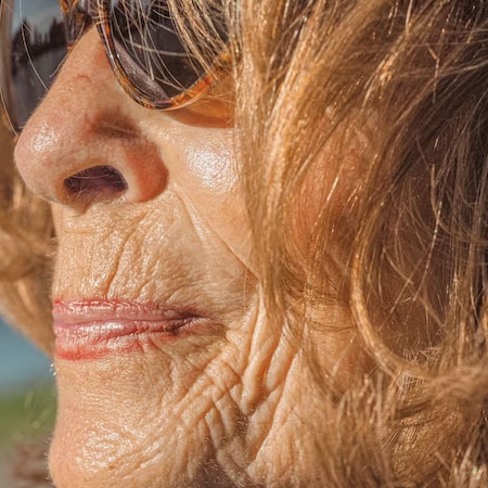 Il sole invecchia la pelle, causando danno biologico irreversibile