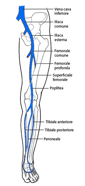 La sindrome post trombotica