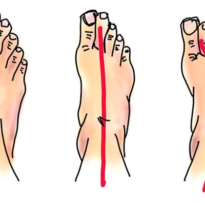 Le gambe gonfie: da cosa sono causate?