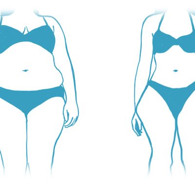 Obesità o lipedema?
