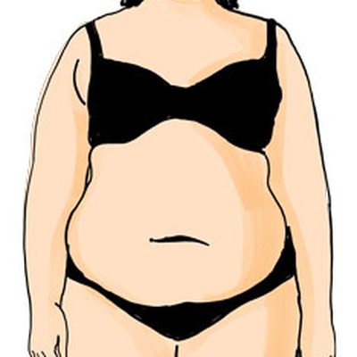 L’obesità e la correlazione col lipo-linfedema