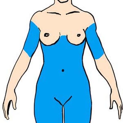 Liposuzione d’eccellenza a Milano