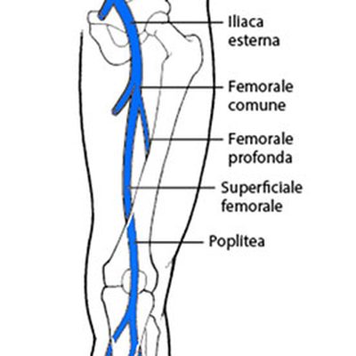 La sindrome post trombotica