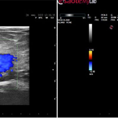 L’esame EcoColorDoppler rapido e senza attese a Milano