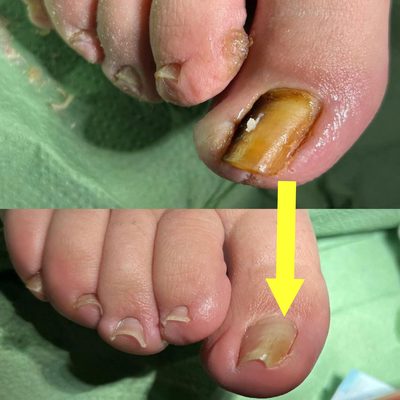 Pedicure sanitaria e Servizio Podologico a Milano