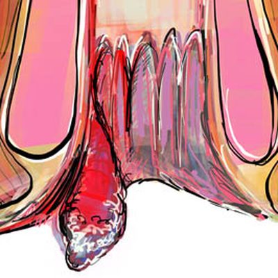 La perdita di sangue e il dolore durante l’evacuazione