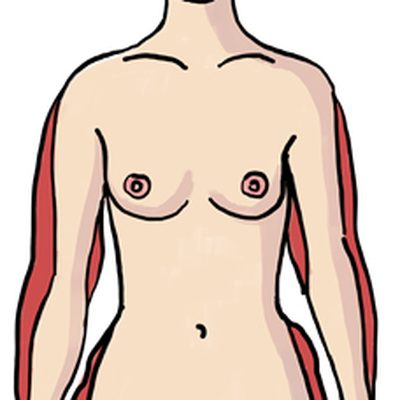 La diagnosi del lipedema: come si esegue, chi è il Medico che può effettuarla?