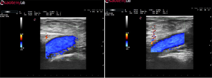 EcoColorDoppler in centro a Milano