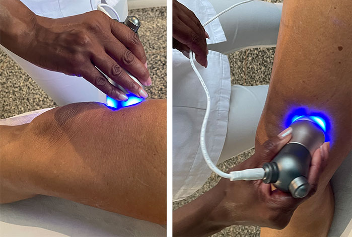 Radiofrequenza Medica a Milano per cosce e gambe