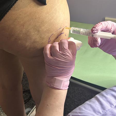 Fosfatidilcolina per mesoterapia Lipodissolve