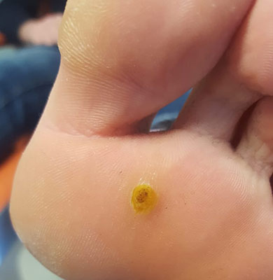 Podologo pedicure sanitaria a Milano