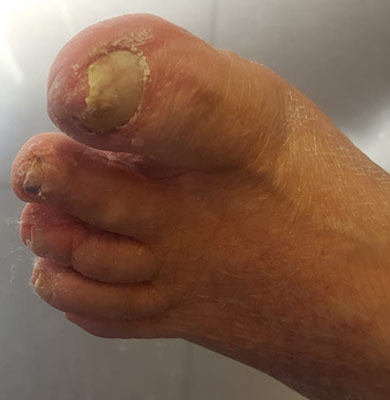 Podologo pedicure sanitaria a Milano