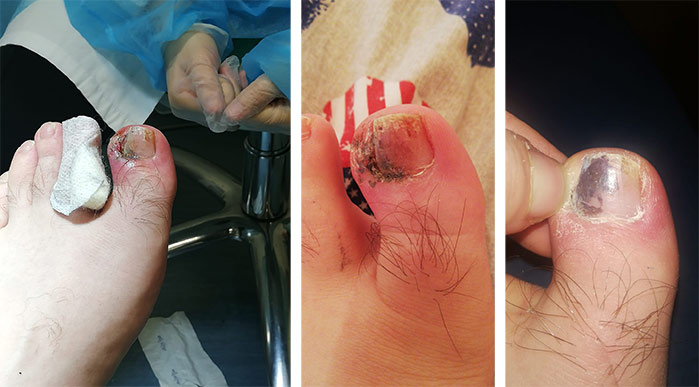 Podologo pedicure sanitaria a Milano