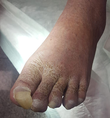 Podologo pedicure sanitaria a Milano