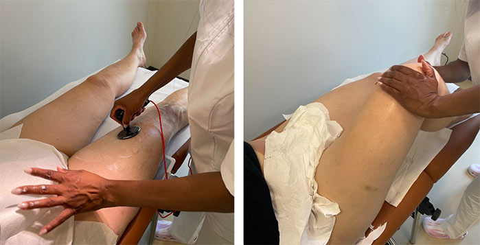 Radiofrequenza Medica a Milano per cosce e gambe