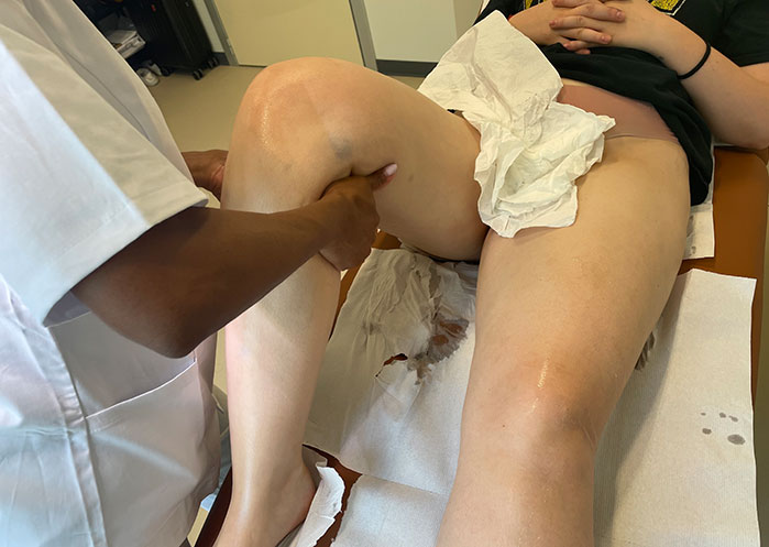 Radiofrequenza Medica a Milano per cosce e gambe