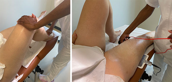 Radiofrequenza Medica a Milano per cosce e gambe