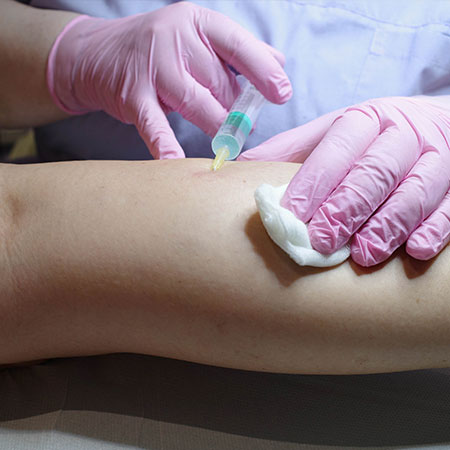 Scleromousse: preparazione della gamba del paziente