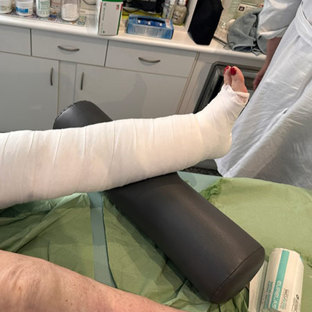 Terapia elastocompressiva del linfedema