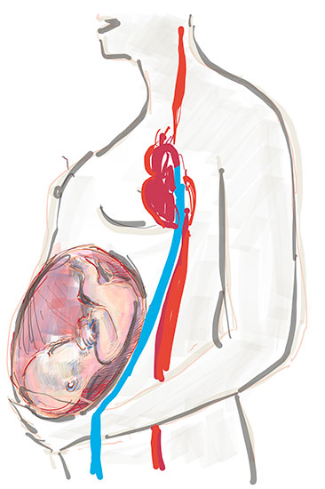 Le emorroidi duranrte la gravidanza ed il peso del feto
