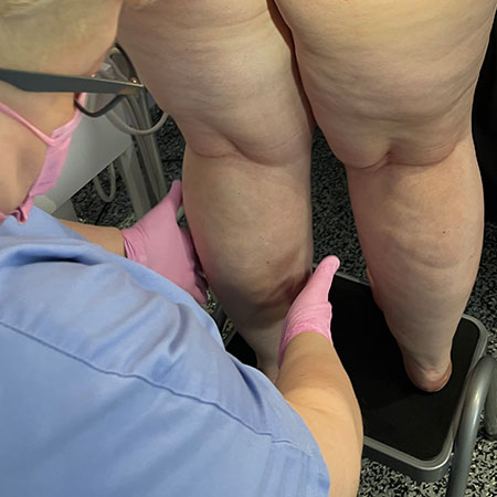 Gambe gonfie in gravidanza