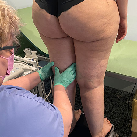 Gambe gonfie e dolenti in gravidanza