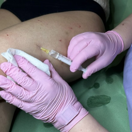 Chirurgo Vascolare Cura delle Vene Varicose a Milano