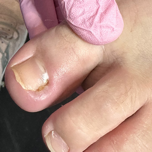Pedicure sanitaria a Milano