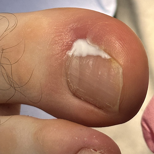 Pedicure sanitaria a Milano