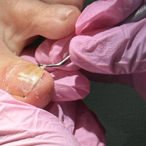 Pedicure sanitaria a Milano