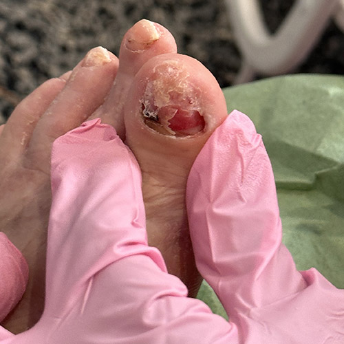 Pedicure sanitaria a Milano