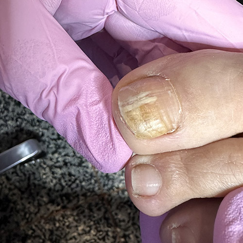 Pedicure sanitaria a Milano